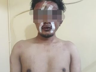 Nyungsep ke Parit Setelah Dikejar Warga, Seorang Begal Bersajam Babak Belur Dikeroyok Massa