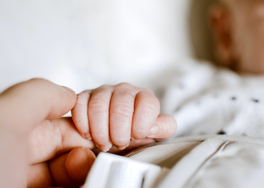 Warga Asahan Lahirkan Bayi Kembar Siam, Punya Tiga Kaki