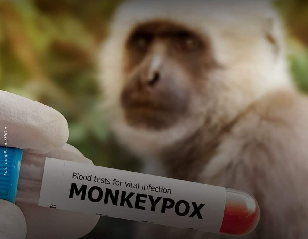 Awas! Kasus Cacar Monyet Pertama di Indonesia Ditemukan di Jakarta