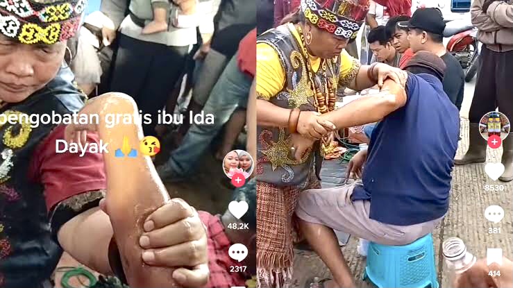 Soal Pengobatan Ida Dayak, Dokter Sebut Lama-lama akan Hilang Sendiri