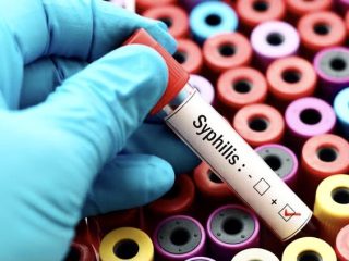 Kasus Meningkat, Kemenkes Pastikan Stok Obat Sifilis Aman 