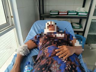 Polisi Buru Pelaku Penyiraman Air Keras Terhadap Seorang Wanita di Madina