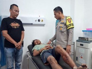 Remaja 18 Tahun Jadi Begal, Polres Pelabuhan Belawan Tembak Kaki Kanannya!