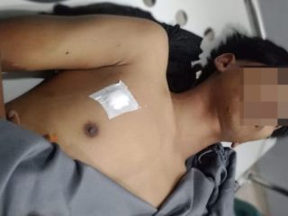 Warga 2 Lorong di Belawan Bentrok, Seorang Remaja Meninggal Dunia