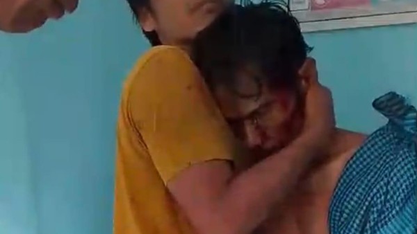 Diserang Beruang Saat Menanam Sawit, Petani di Sumsel Kritis
