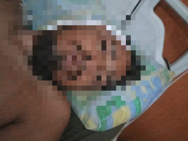 Ketua IWO Bantaeng Jadi Korban Pembacokan, Zulkifli Thahir: Tangkap Pelaku!