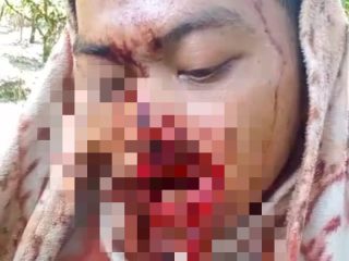 Ngeri! Amuk Harimau Sumatera di Gayo Lues, Seorang Petani Singah Mulo Luka Parah Diterkam
