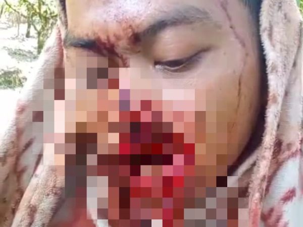 Ngeri! Amuk Harimau Sumatera di Gayo Lues, Seorang Petani Singah Mulo Luka Parah Diterkam