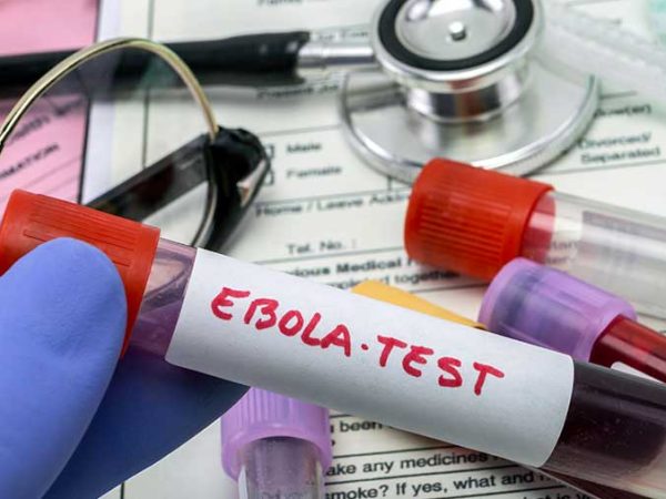 AS Perketat Skrining Bandara Usai Seorang Warganya Terindikasi Tertular Ebola di Kongo