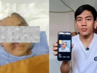 Kondisi Terkini Perempuan yang Disekap Pacara 3 Tahun, Wajah Hancur dan Buta Permanen