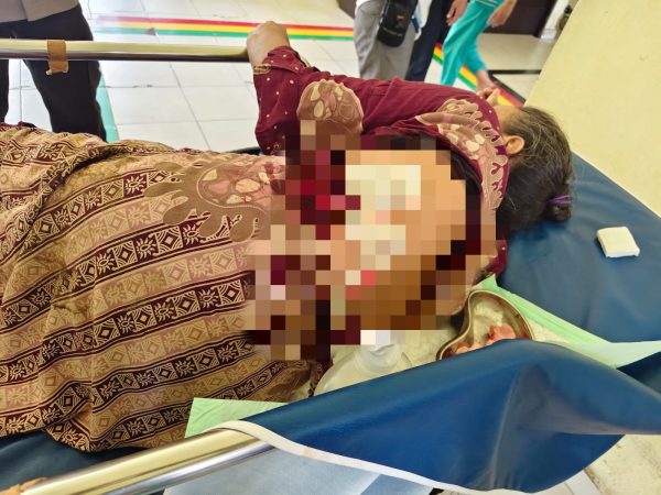 Kawanan Kera Liar Serang Permukiman Warga di Tembilahan, Sudah 18 Orang Jadi Korban 